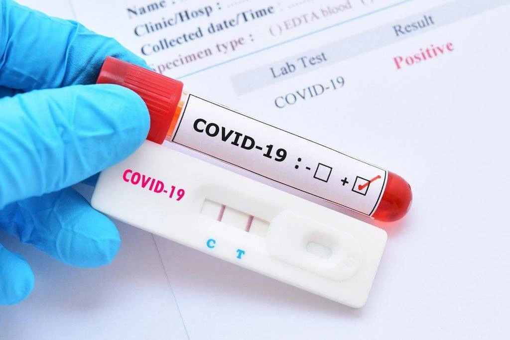 Lietuvoje 2 848, Panevėžyje 89 nauji COVID-19 atvejai