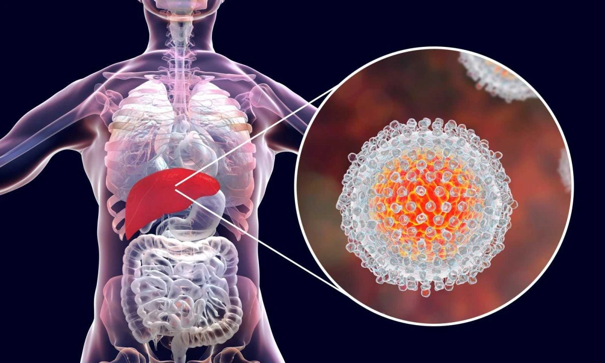 0001 hepatitas 1658997985