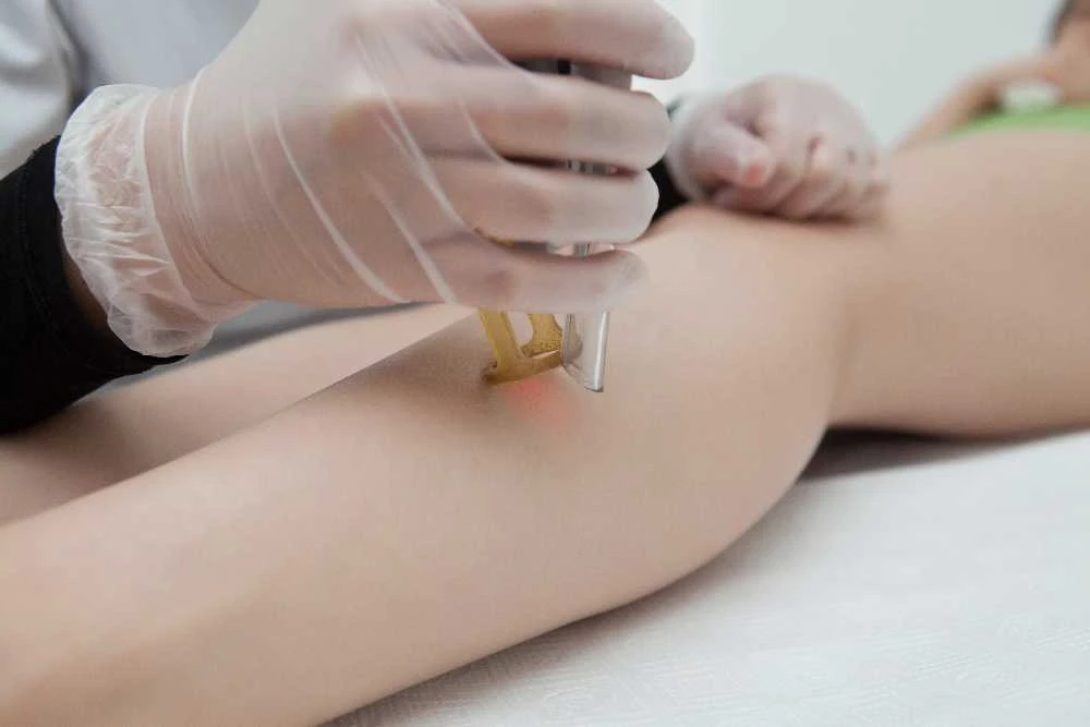 Plaukų šalinimo būdai: kuris veiksmingiausias?