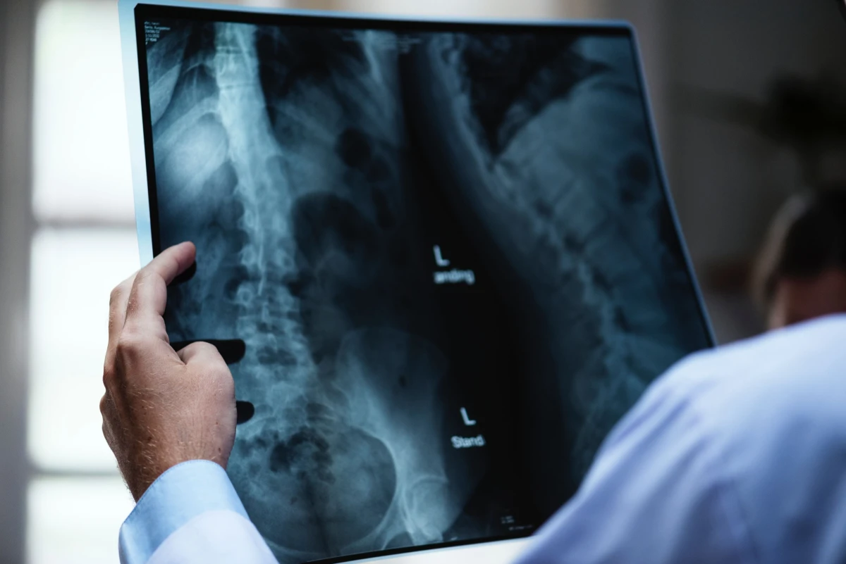 Mitai ir baimės dėl medicininės apšvitos poveikio: kodėl (ne)verta baimintis?