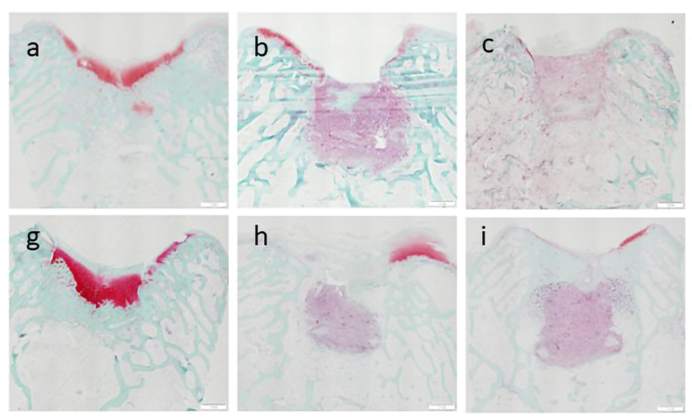 Efektyvesniam osteoartrito gydymui – KTU ir LSMU mokslininkų patentuota technologija, padedanti atkurti pažeistą kremzlę